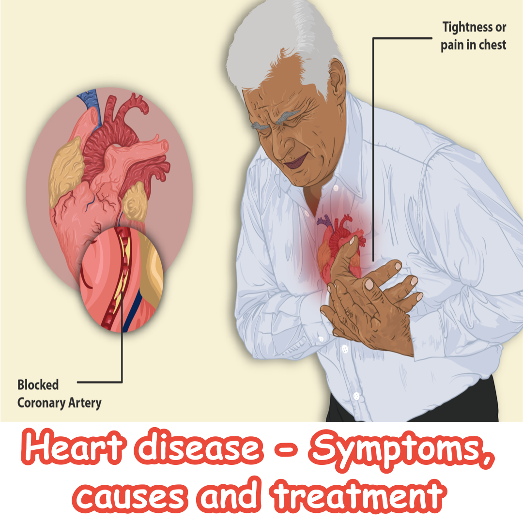 heart-disease